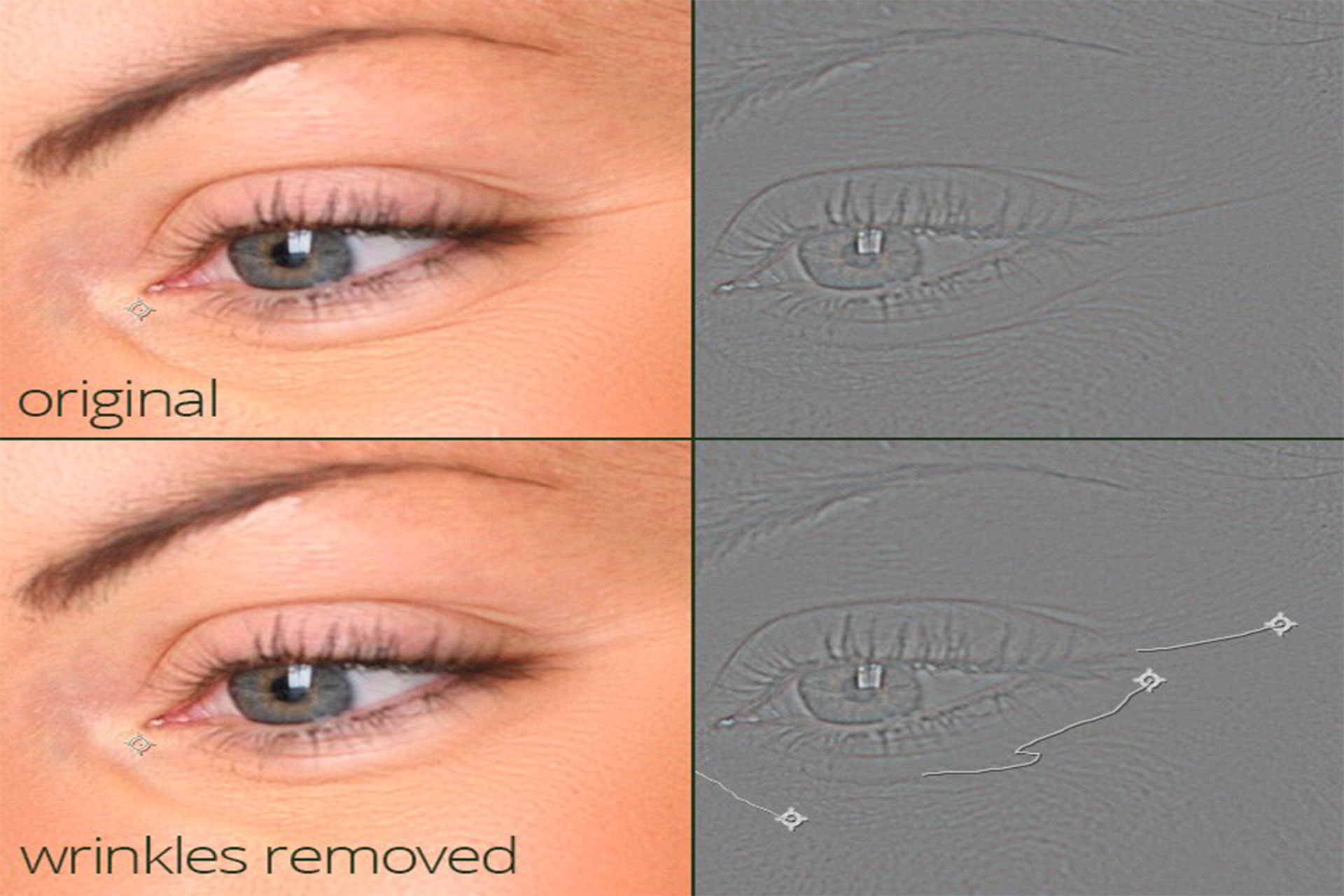 After Effect Plugin Skin Retouch